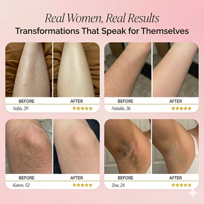 Lamazya® Trimmer 2.0